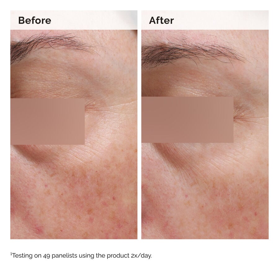 niacinamide-5-face-and-body-emulsion-x4 2024-08-23-ORD-Nia-5pct-Face-Body-B-A-Elasticity-Global-02-1x1.jpg