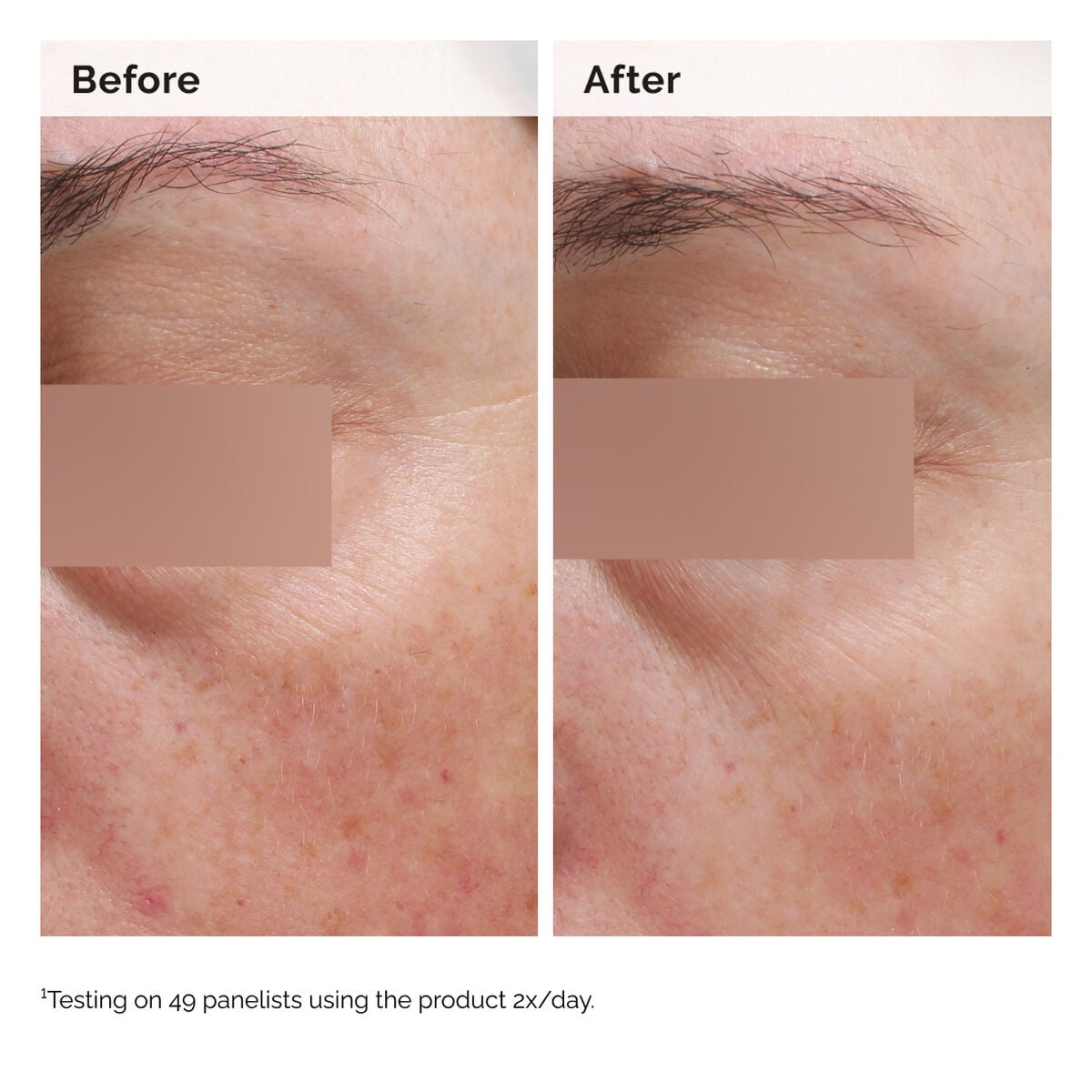 niacinamide-5-face-and-body-emulsion-x4 2024-08-23-ORD-Nia-5pct-Face-Body-B-A-Elasticity-Global-02-1x1.jpg