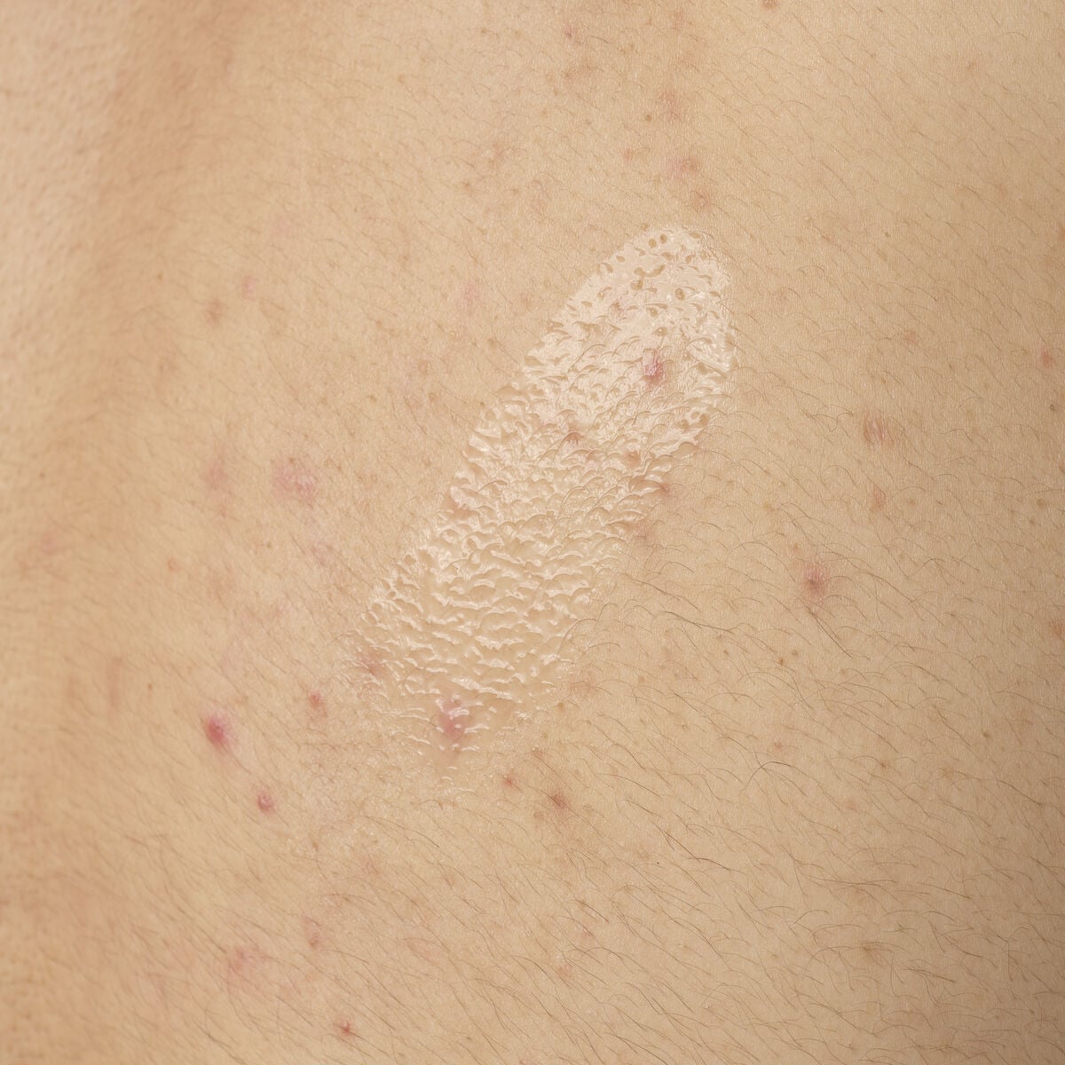 salicylic-acid-0-5-body-serum-s6 ORD-salicylic-acid-05-body-240ml-application.jpg