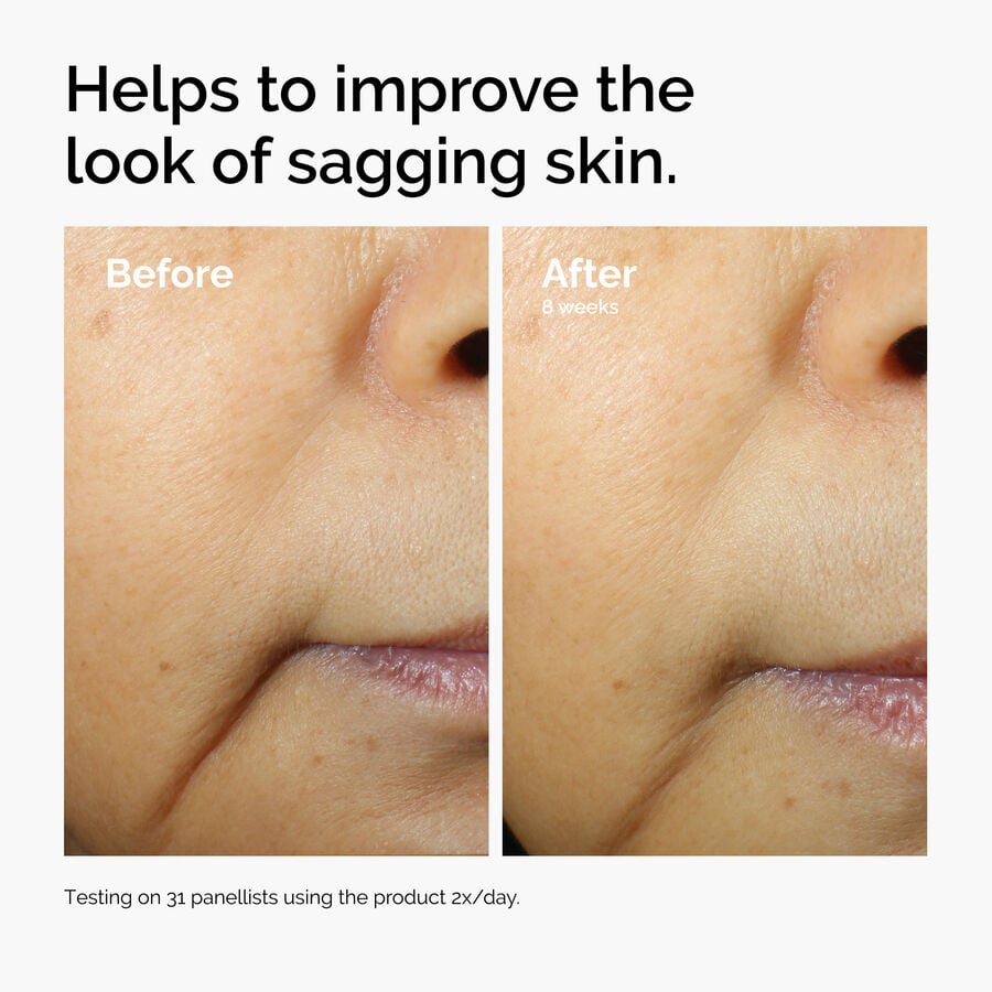 caffeine-3-escin-1-face-serum-i1 ord-caffeine-3pct-escin-1pct-face-serum-before-after-sagging.jpg