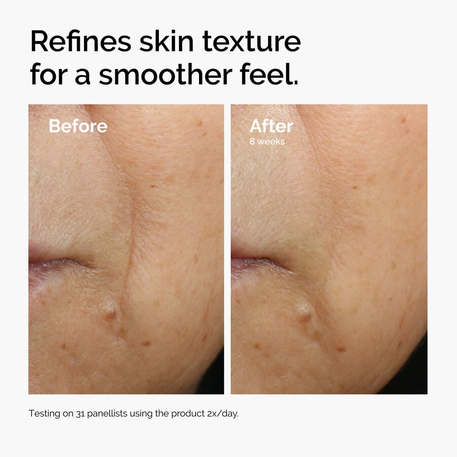 caffeine-3-escin-1-face-serum-i1 ord-caffeine-3pct-escin-1pct-face-serum-before-after-texture.jpg