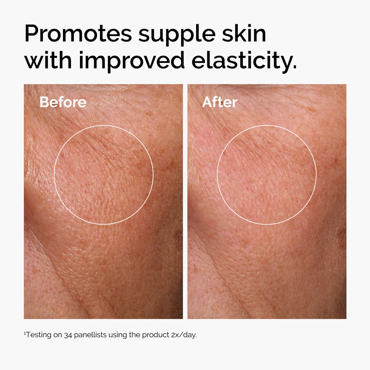 hyaluronic-acid-2-b5-with-ceramides-b8 ord-hyaluronic-acid-2pct-b5-hydrating-serum-before-after-elasticity.jpg