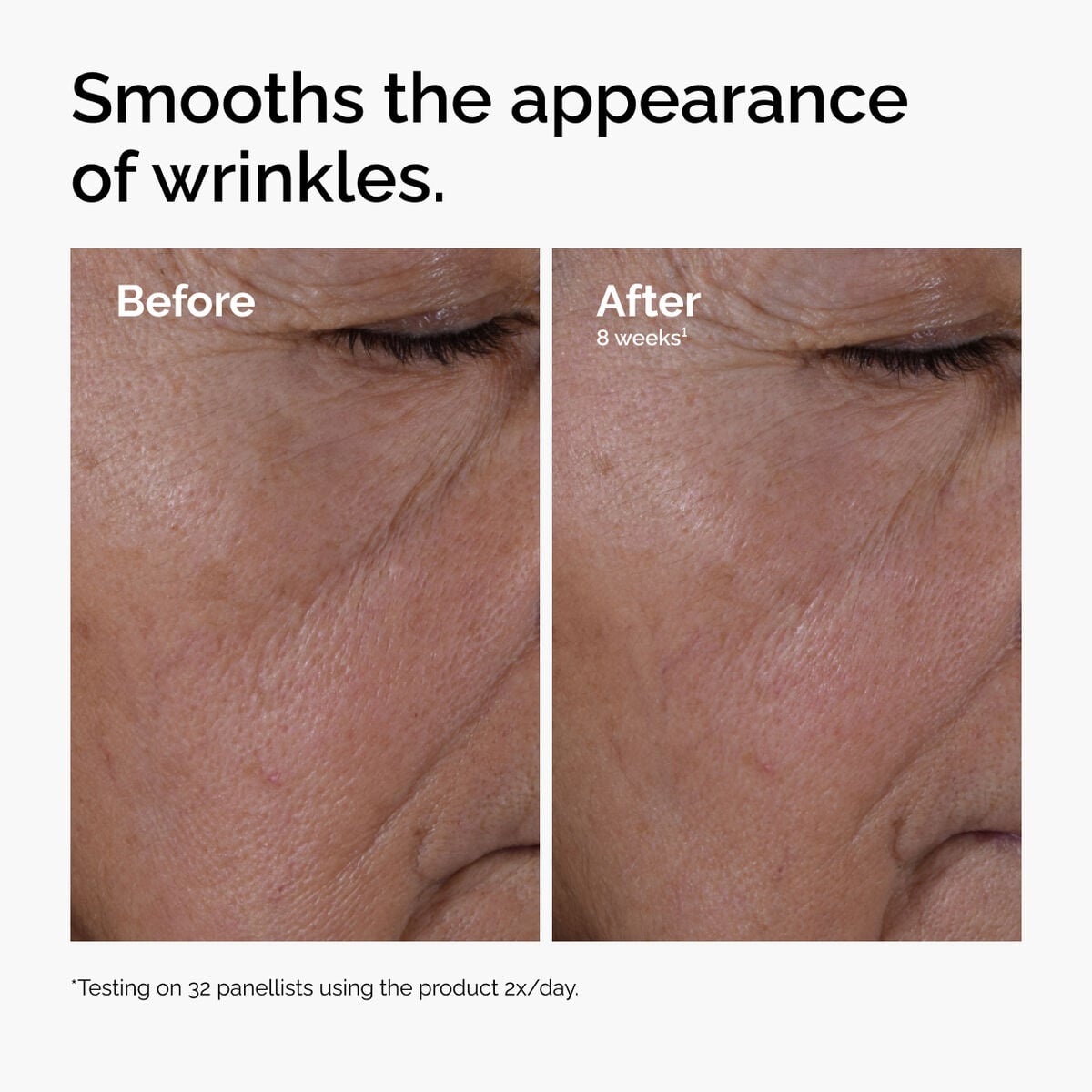 multi-peptide-ha-serum-s5 ord-multi-peptide-ha-serum-wrinkles-before-after.jpg