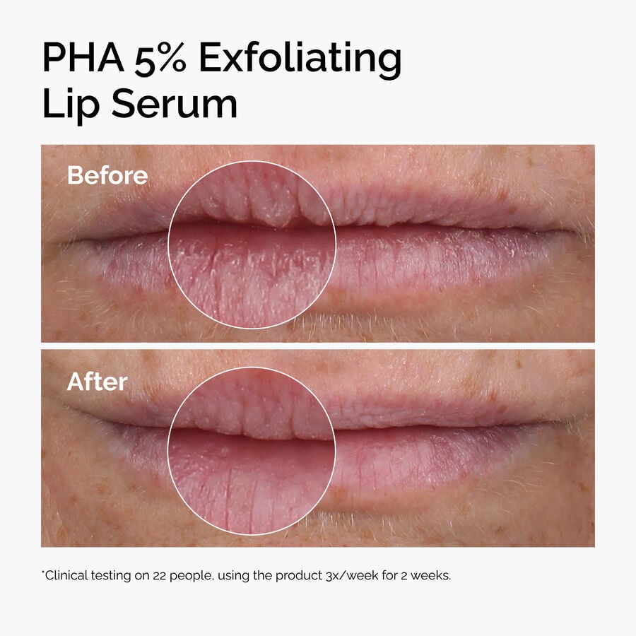 pha-5-exfoliating-lip-serum-y9 ord-pha-5pct-lip-exfoliating-serum-before-after.jpg