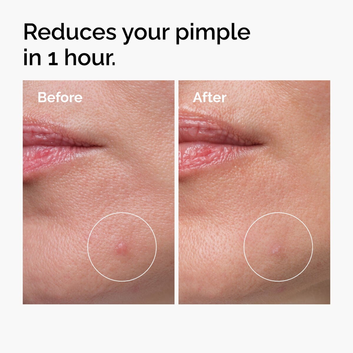 sulfur-10-powder-to-cream-concentrate-w9 ord-sulfur-10pct-powder-to-cream-concentrate-before-after-NA.jpg